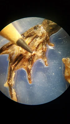 Frog foot in a micrscopte